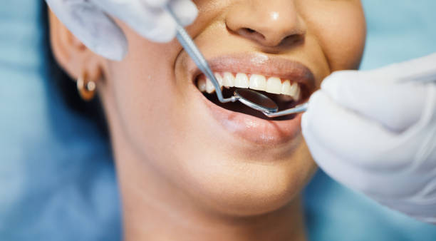 Best Chipped Tooth Repair Near Me  in Immokalee, FL